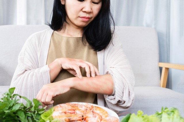 Mengenal Ciri-ciri Alergi Makanan yang Harus Diwaspadai!